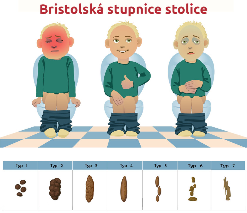 Bristolská stupnice stolice